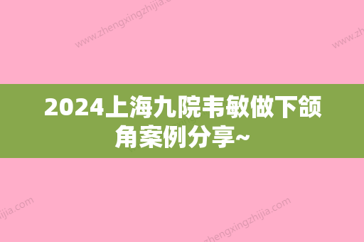 2024上海九院韦敏做下颌角案例分享~