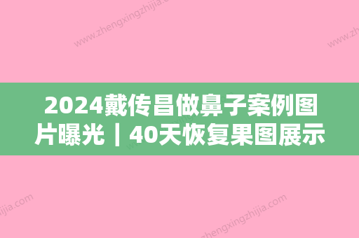 2024戴传昌做鼻子案例图片曝光｜40天恢复果图展示