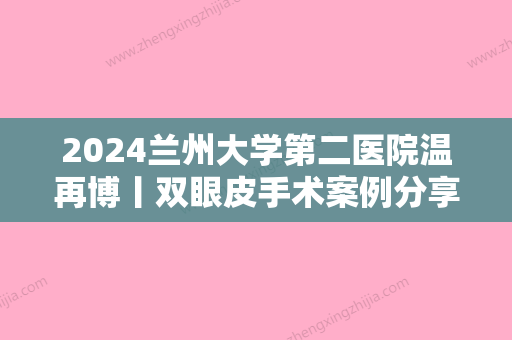 2024兰州大学第二医院温再博丨双眼皮手术案例分享~