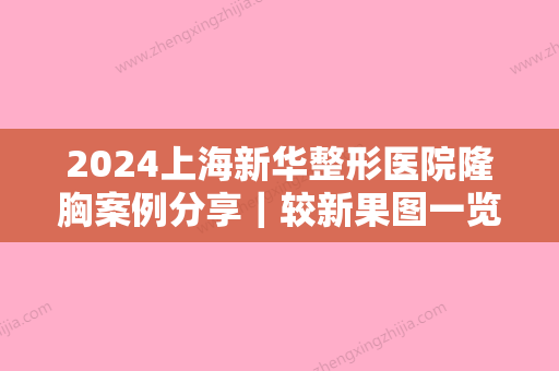 2024上海新华整形医院隆胸案例分享｜较新果图一览~