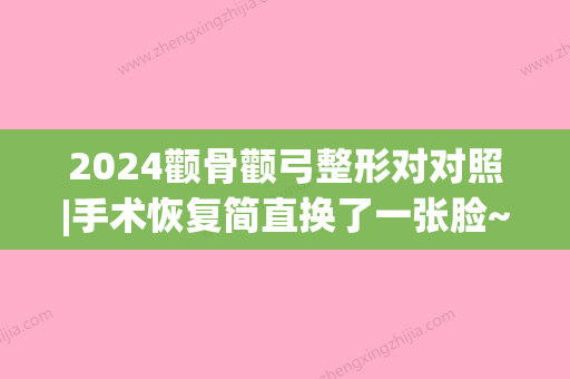 2024颧骨颧弓整形对对照|手术恢复简直换了一张脸~