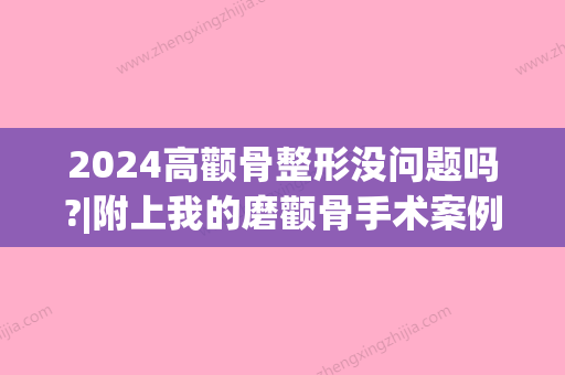 2024高颧骨整形没问题吗?|附上我的磨颧骨手术案例~