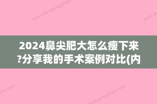 2024鼻尖肥大怎么瘦下来?分享我的手术案例对比(内附价格表)~