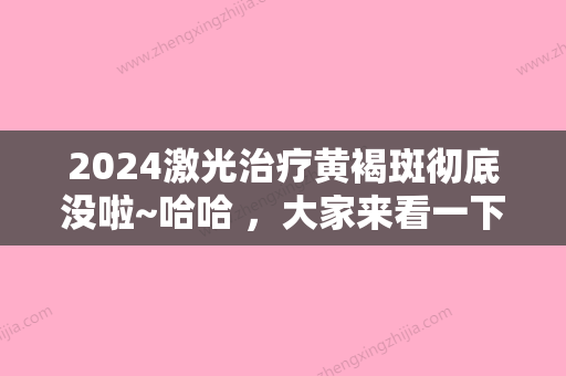 2024激光治疗黄褐斑彻底没啦~哈哈 ，大家来看一下对比图