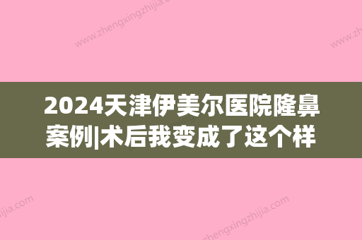 2024天津伊美尔医院隆鼻案例|术后我变成了这个样子～(天津伊美尔医疗整形医院)