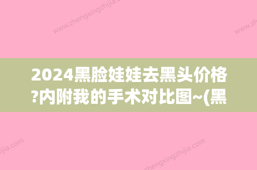 2024黑脸娃娃去黑头价格?内附我的手术对比图~(黑脸娃娃一次大概多少钱)