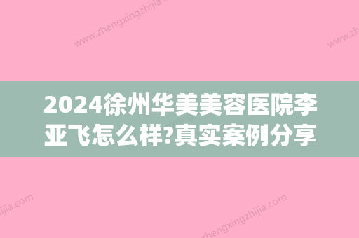 2024徐州华美美容医院李亚飞怎么样?真实案例分享~?(徐州华美整形美容)