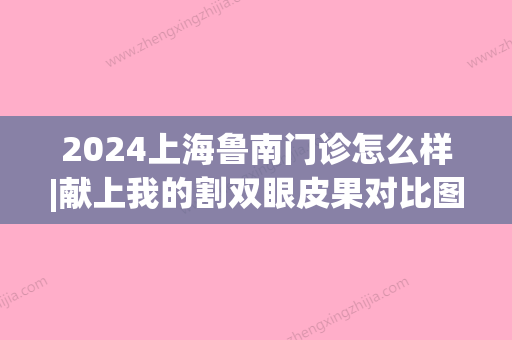 2024上海鲁南门诊怎么样|献上我的割双眼皮果对比图(上海鲁南门诊整形医院)