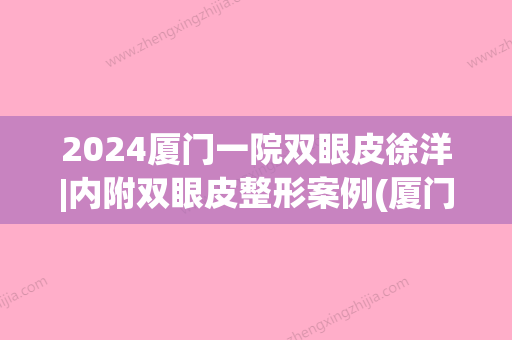 2024厦门一院双眼皮徐洋|内附双眼皮整形案例(厦门第一医院徐洋双眼皮)