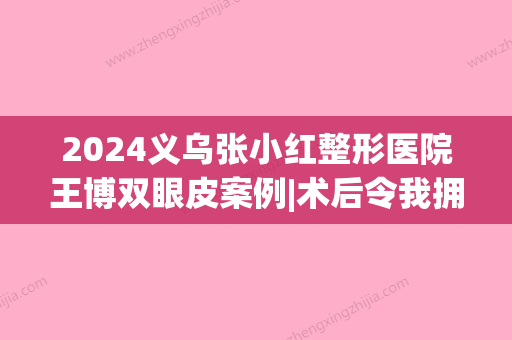 2024义乌张小红整形医院王博双眼皮案例|术后令我拥有大眼睛(义乌割的双眼皮张小红{规范})