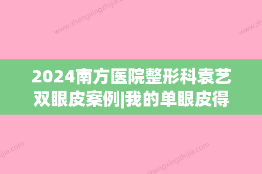 2024南方医院整形科袁艺双眼皮案例|我的单眼皮得救了～(南方医院整形外科袁艺)