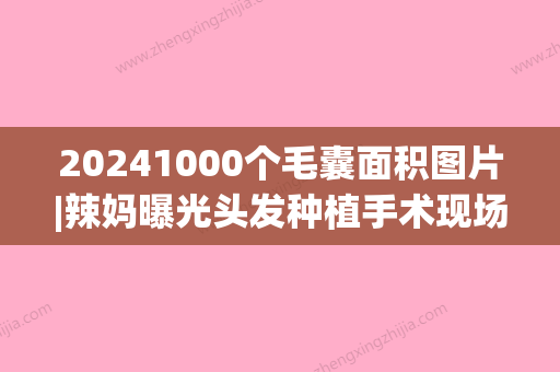 20241000个毛囊面积图片|辣妈曝光头发种植手术现场图~(植发200个毛囊有多少)