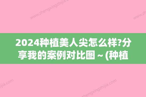 2024种植美人尖怎么样?分享我的案例对比图～(种植美人尖要多少钱)