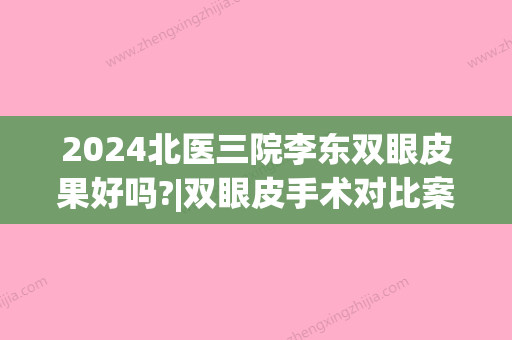 2024北医三院李东双眼皮果好吗?|双眼皮手术对比案例恢复图片~(北医三院双眼皮李东价格)