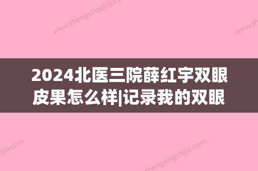 2024北医三院薛红宇双眼皮果怎么样|记录我的双眼皮真实案例~(北医三院薛红宇双眼皮多少钱)