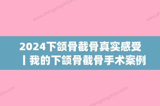 2024下颌骨截骨真实感受丨我的下颌骨截骨手术案例分享~(下颌骨截断)