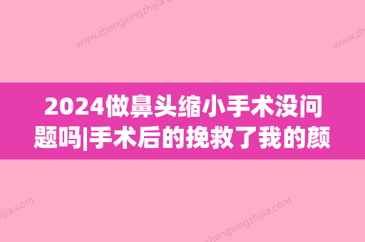 2024做鼻头缩小手术没问题吗|手术后的挽救了我的颜值~(鼻头缩小手术后的照片)