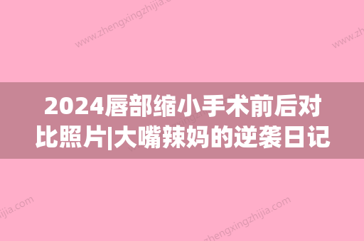 2024唇部缩小手术前后对比照片|大嘴辣妈的逆袭日记~(上嘴唇缩小手术)