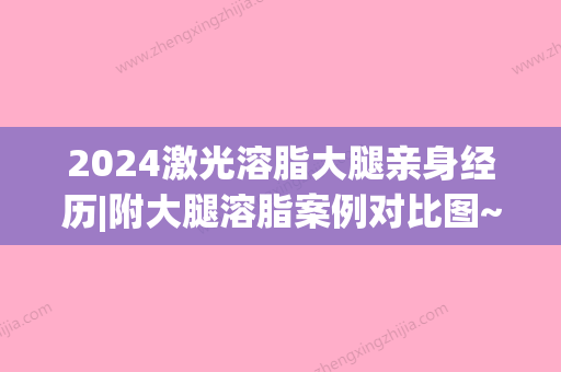 2024激光溶脂大腿亲身经历|附大腿溶脂案例对比图~(大腿射频溶脂)