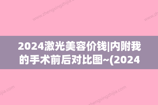 2024激光美容价钱|内附我的手术前后对比图~(2024激光手术价格)