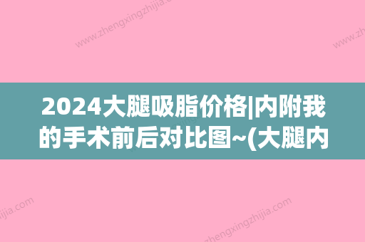 2024大腿吸脂价格|内附我的手术前后对比图~(大腿内侧吸脂价格)