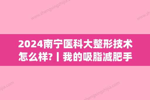 2024南宁医科大整形技术怎么样?丨我的吸脂减肥手术果~(南宁医科大整形价格)