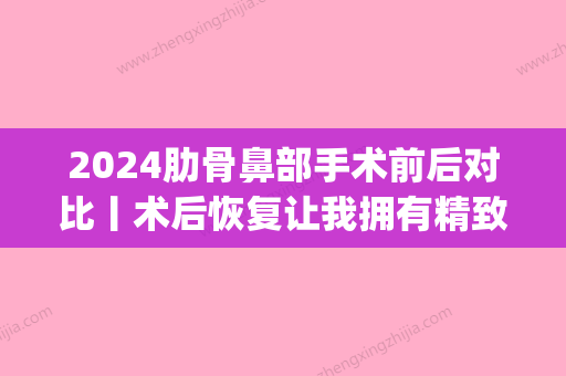 2024肋骨鼻部手术前后对比丨术后恢复让我拥有精致鼻梁~(肋骨鼻手术肋骨需要恢复多久)