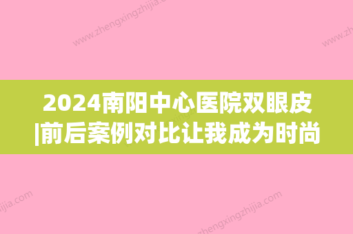 2024南阳中心医院双眼皮|前后案例对比让我成为时尚的弄儿~(南阳埋线双眼皮)