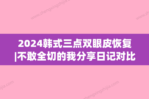 2024韩式三点双眼皮恢复|不敢全切的我分享日记对比图~(韩式3点双眼皮恢复照)