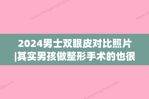 2024男士双眼皮对比照片|其实男孩做整形手术的也很多~(双眼皮手术男生图片)