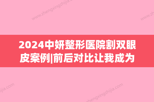 2024中妍整形医院割双眼皮案例|前后对比让我成为时尚的弄儿~(中妍整形医院在线)