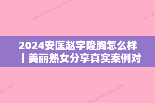 2024安医赵宇隆胸怎么样丨美丽熟女分享真实案例对比图~