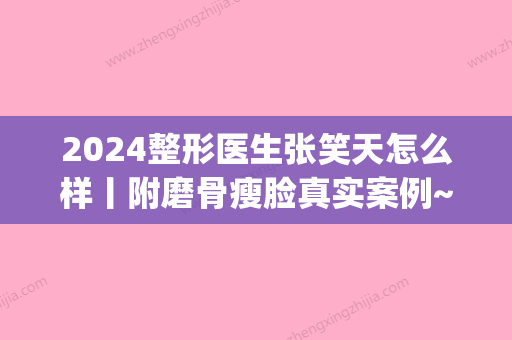 2024整形医生张笑天怎么样丨附磨骨瘦脸真实案例~(张笑天有磨骨资格吗)