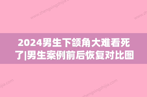 2024男生下颌角大难看死了|男生案例前后恢复对比图~(男生下颚角宽)