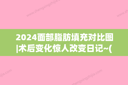 2024面部脂肪填充对比图|术后变化惊人改变日记~(二次面部脂肪填充比较好时间)