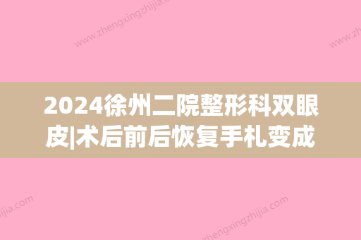 2024徐州二院整形科双眼皮|术后前后恢复手札变成大眼睛~(徐州二院和徐州三院割双眼皮)