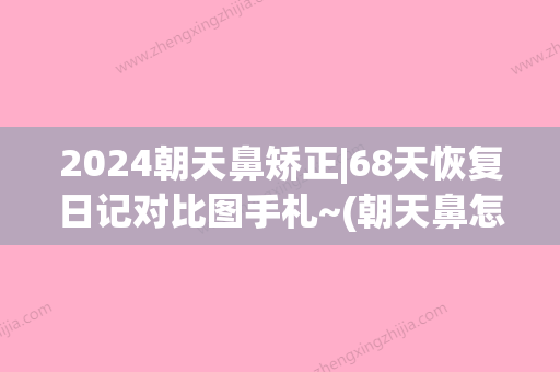 2024朝天鼻矫正|68天恢复日记对比图手札~(朝天鼻怎么自我矫正)