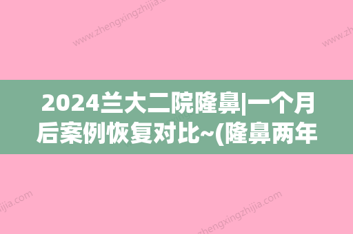 2024兰大二院隆鼻|一个月后案例恢复对比~(隆鼻两年后)