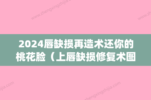 2024唇缺损再造术还你的桃花脸（上唇缺损修复术图片）(唇腭裂三度修复后图片)