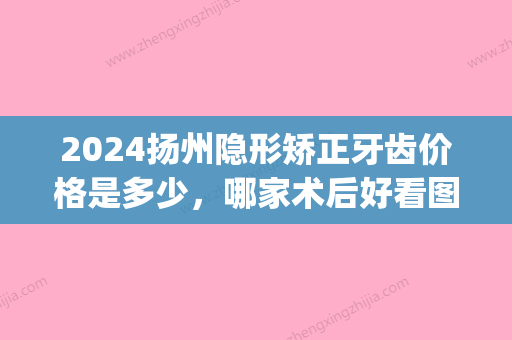 2024扬州隐形矫正牙齿价格是多少，哪家术后好看图就知道了(扬州牙齿矫正价格表)