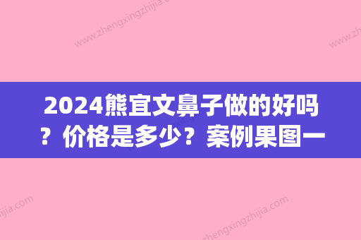 2024熊宜文鼻子做的好吗？价格是多少？案例果图一览(熊宜文做鼻子怎么样)