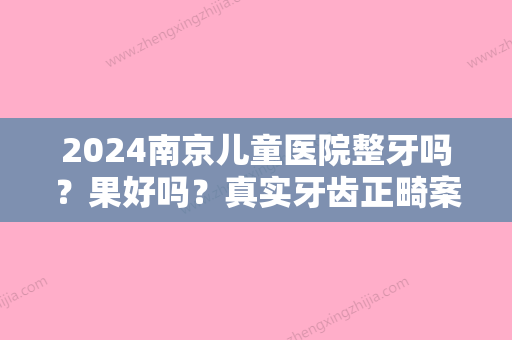 2024南京儿童医院整牙吗？果好吗？真实牙齿正畸案例！