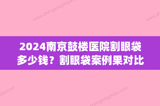 2024南京鼓楼医院割眼袋多少钱？割眼袋案例果对比图片(南京割眼袋要多少费用)