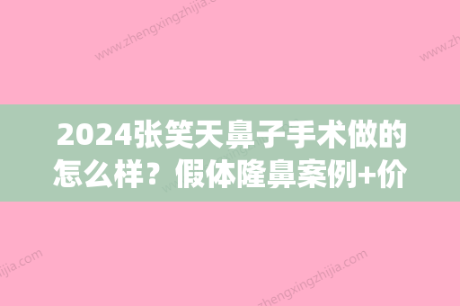 2024张笑天鼻子手术做的怎么样？假体隆鼻案例+价格表(假体隆鼻后多久可以大笑)