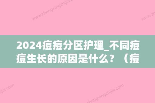 2024痘痘分区护理_不同痘痘生长的原因是什么？（痘痘原因分几种）