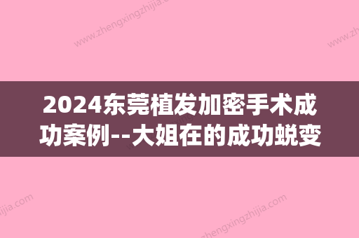 2024东莞植发加密手术成功案例--大姐在的成功蜕变(东莞植发要多久)