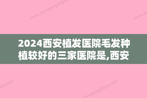 2024西安植发医院毛发种植较好的三家医院是,西安西京医院植发科、西京领衔颧骨