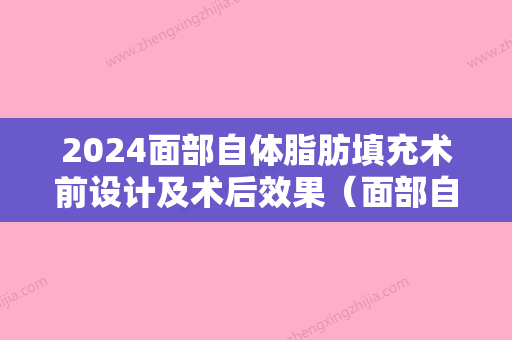 2024面部自体脂肪填充术前设计及术后效果（面部自体脂肪填充术前设计及术后效果评价）