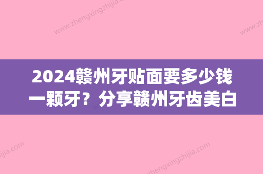 2024赣州牙贴面要多少钱一颗牙？分享赣州牙齿美白贴面价格(南昌牙贴面多少钱一颗)