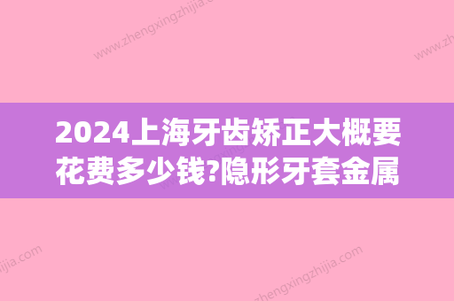 2024上海牙齿矫正大概要花费多少钱?隐形牙套金属矫正价格都有(上海牙齿矫正多少费用多少钱)